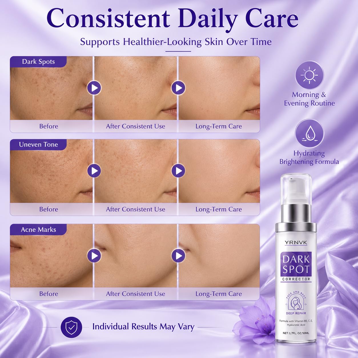 Dark Spot Remover for Face & Body. Brightening Serum with Vitamin C & Hyaluronic Acid. Corrector for Age Spots. Melasma & Freckles. Hyperpigmentation Treatment for Women & Men 1.70 FL OZ : Beauty & Personal Care
