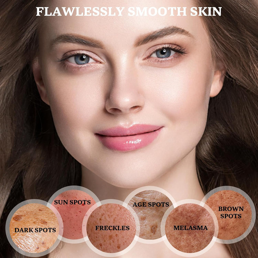 Dark Spot Remover for Face and Body: Dark Spot Corrector Cream. Melasma. Freckle. Sun Spot. Age Spot Remover with Niacinamide and Vitamin C - 1.7 Fl Oz : Beauty & Personal Care