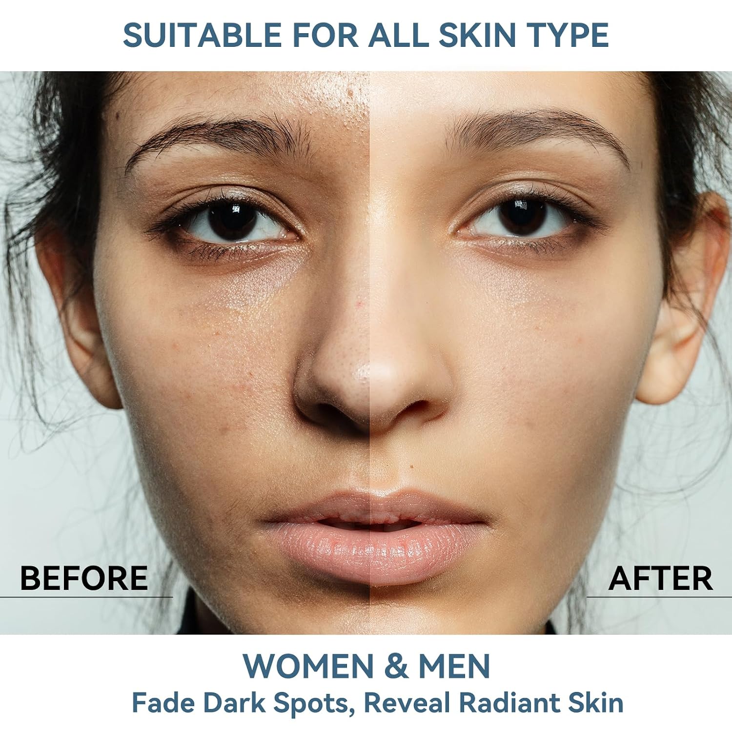 Dark Spot Remover for Face and Body. Dark Spot Corrector Serum. Melasma. Age Spot & Freckles Remover. Skin Care Serum for Uneven Skin Tone with 360° Roller Massage Ball