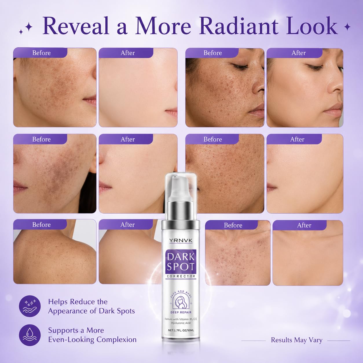 Dark Spot Remover for Face & Body. Brightening Serum with Vitamin C & Hyaluronic Acid. Corrector for Age Spots. Melasma & Freckles. Hyperpigmentation Treatment for Women & Men 1.70 FL OZ : Beauty & Personal Care