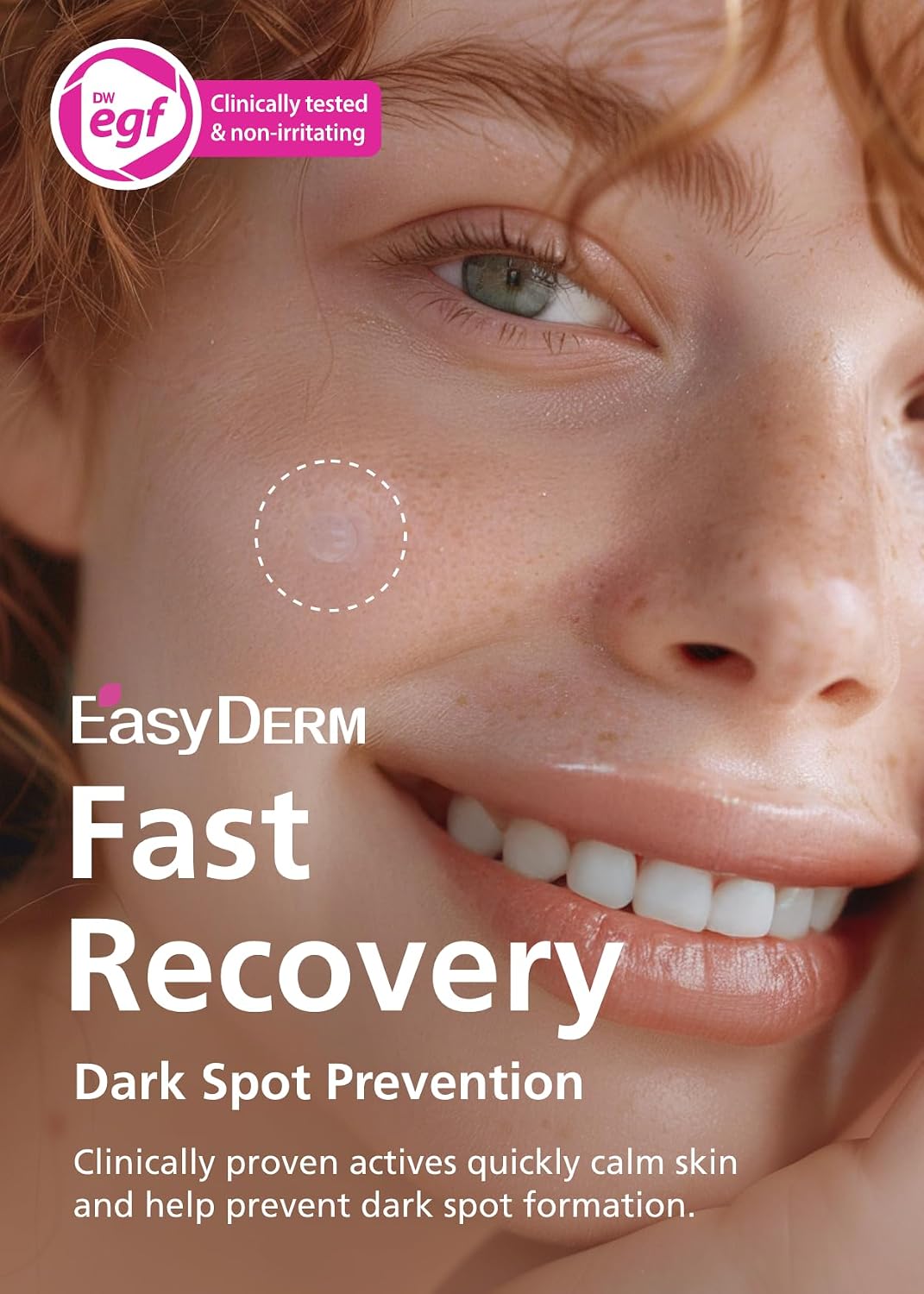 DWEasyDerm EasyDerm Real Calming Pimple Patches. Clear | Niacinamide. Hyaluronic Acid. EGF Acne Dark Spot Care. K-beauty | 6 counts. Micro Point length : 285μm. Summer & Travel Essentials