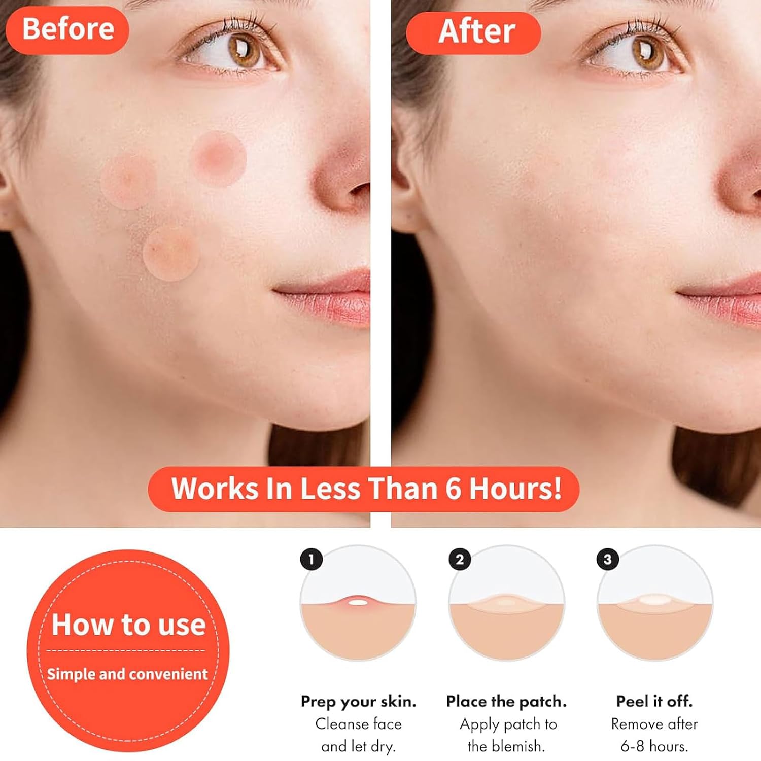Pimple Patches for Face Day and Night 120 Count. Ultra-Thin & Thick Hydrocolloid Acne Patches with Salicylic Acid. Tea Tree Oil. Centella Asiatica. Invisible Zit Patch for Blemishes