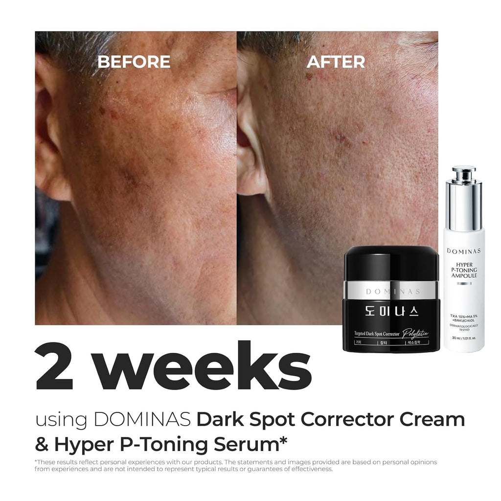 Acid Dark Spot Corrector Cream - Visibly Reduce Age Spots. Sun Spots with TXA. Niacinamide. Bakuchiol. Daily Moisturizer for Uneven Tone & After Spot Care. Korean Skincare. 1.76 oz : Beauty & Personal Care