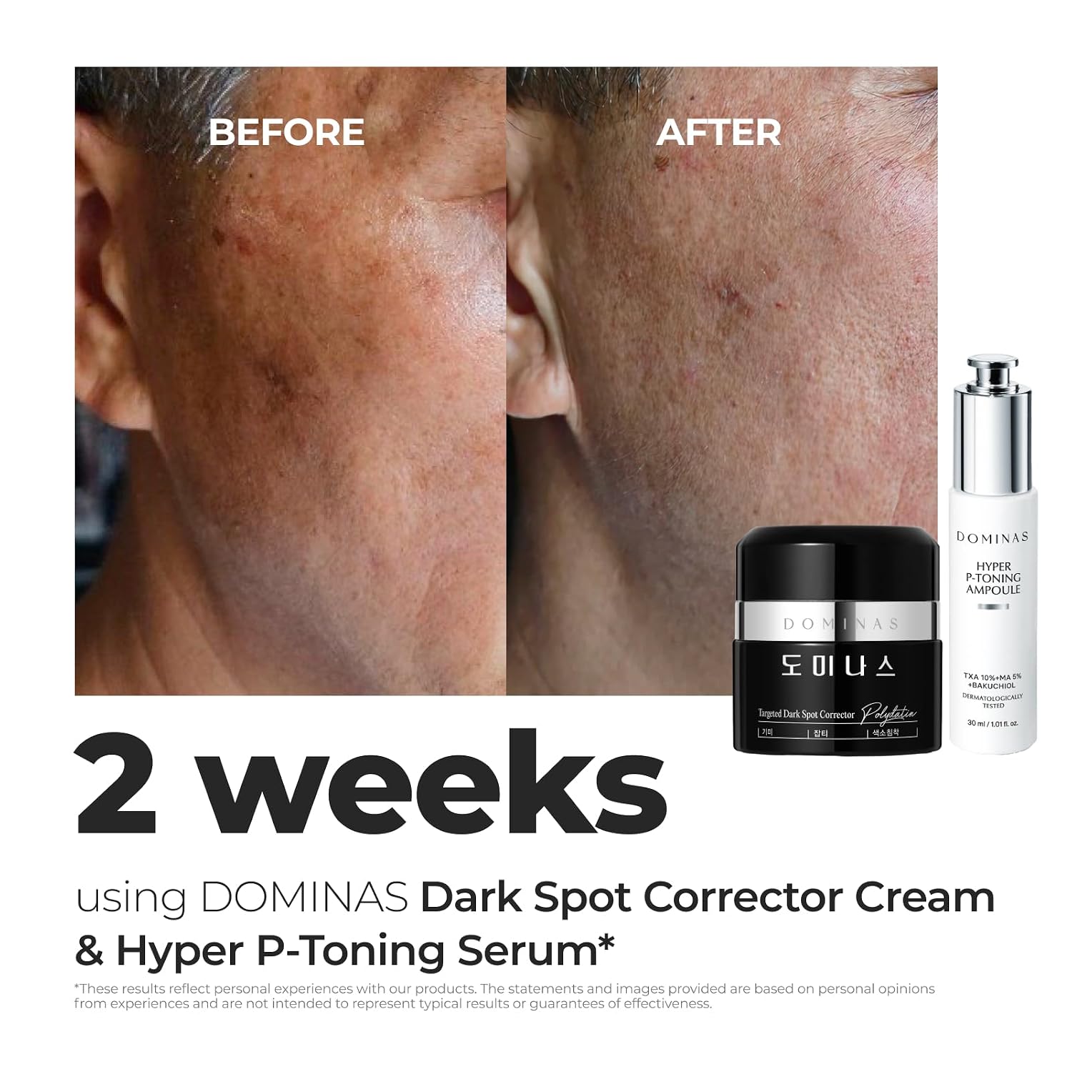 Acid Dark Spot Corrector Cream - Visibly Reduce Age Spots. Sun Spots with TXA. Niacinamide. Bakuchiol. Daily Moisturizer for Uneven Tone & After Spot Care. Korean Skincare. 1.76 oz : Beauty & Personal Care