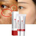 2 Pcs Whitening Freckle Cream. Acne Scar Removal Treatment Cream. Pigmentation Removal Cream for Face. Moisturizing Removes Facial Melasma Dark Spots Wrinkles Blemishes (whitening freckle cream) : Beauty & Personal Care
