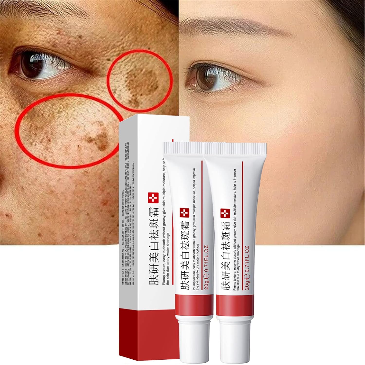 2 Pcs Whitening Freckle Cream. Acne Scar Removal Treatment Cream. Pigmentation Removal Cream for Face. Moisturizing Removes Facial Melasma Dark Spots Wrinkles Blemishes (whitening freckle cream) : Beauty & Personal Care