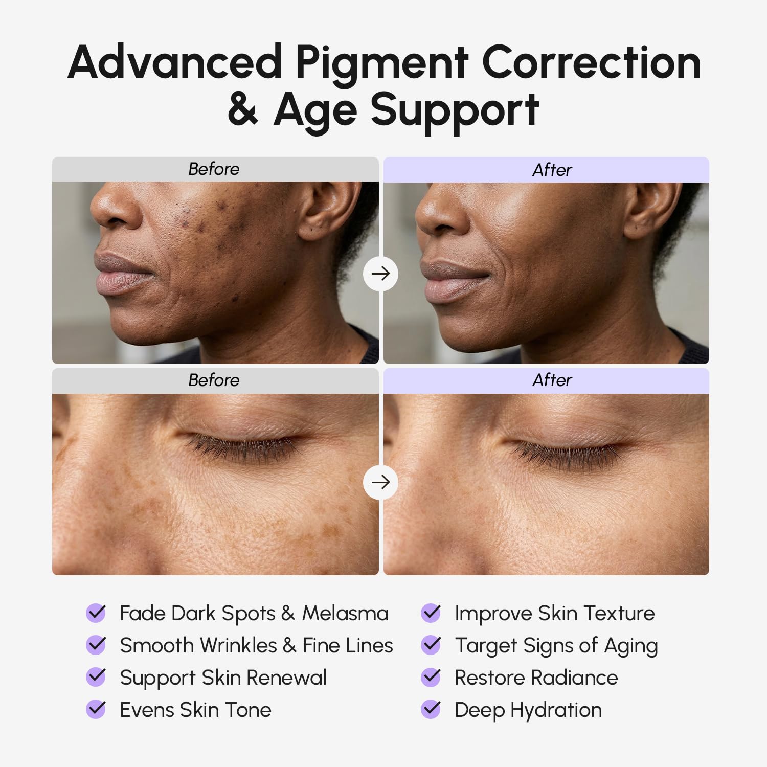 Tranexamic Acid Face Cream - Cream with Alpha Arbutin. Niacinamide. Peptide Complex & Vitamin C - Crema para las Manchas de la Cara