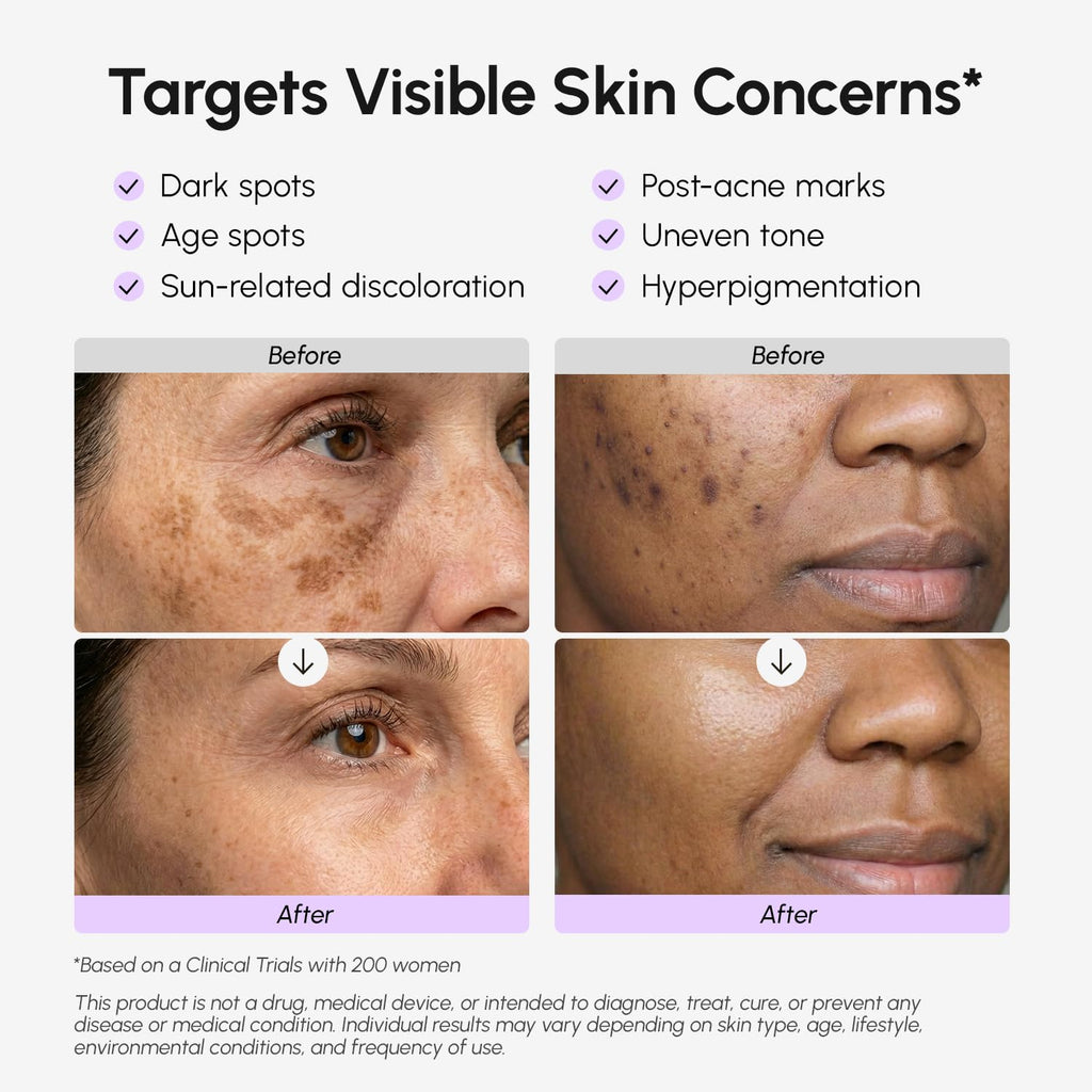 Dark Spot Remover for Face and Body – Dark Spot Corrector Serum – Hyperpigmentation. Melasma. Sun & Age Spots – Black & Brown Spot Remover for Women – Deep Hydration Body & Face Serum : Beauty & Personal Care