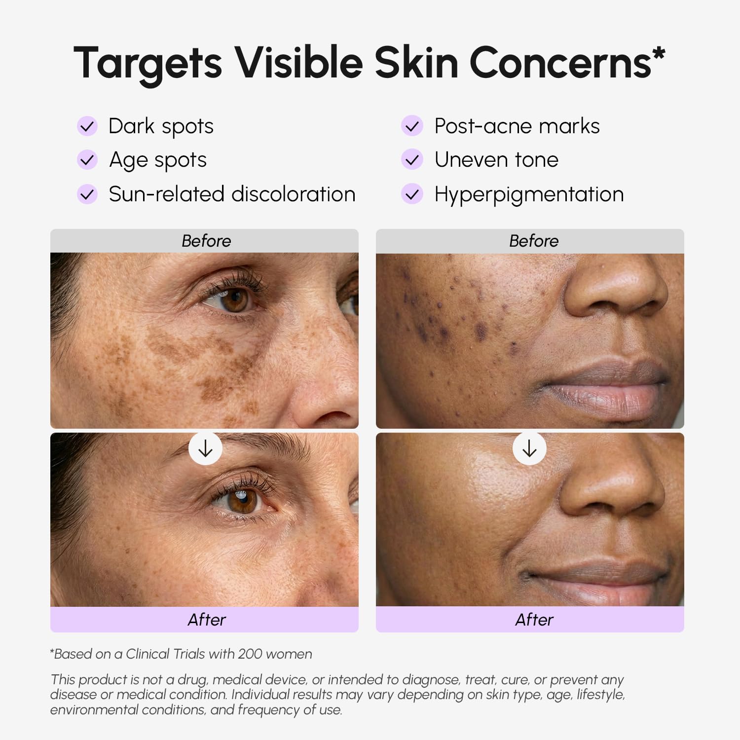 Dark Spot Remover for Face and Body – Dark Spot Corrector Serum – Hyperpigmentation. Melasma. Sun & Age Spots – Black & Brown Spot Remover for Women – Deep Hydration Body & Face Serum : Beauty & Personal Care