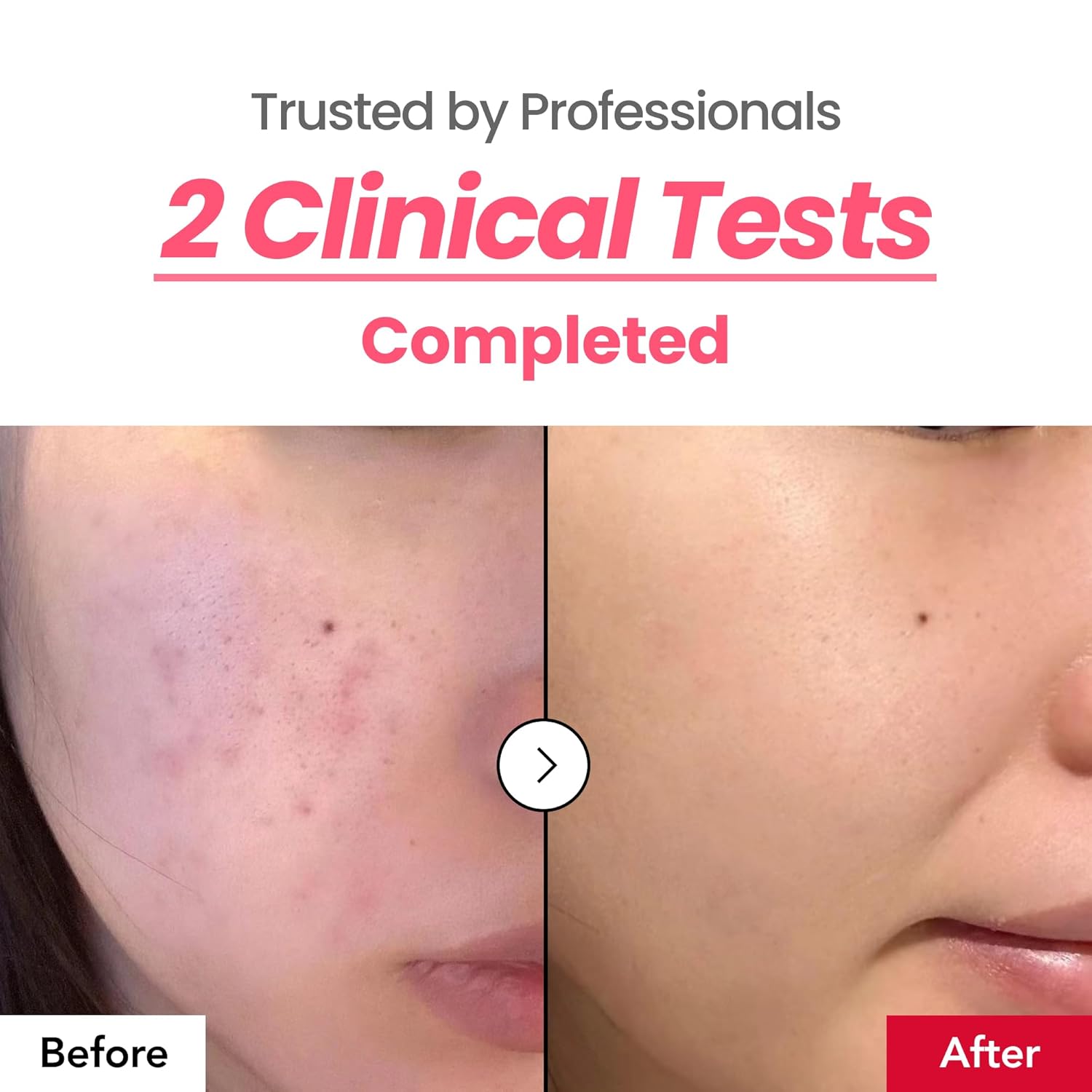 Dark Spot 24% Correcting Pink Glow Cream | Tranexamic Acid 6%. Niacinamide 5%. Dark Spots. Freckle. Blemishes. Pigmentation. Non-Irritating. Korean Skincare. 30ml. 1.01 fl.oz. : Beauty & Personal Care