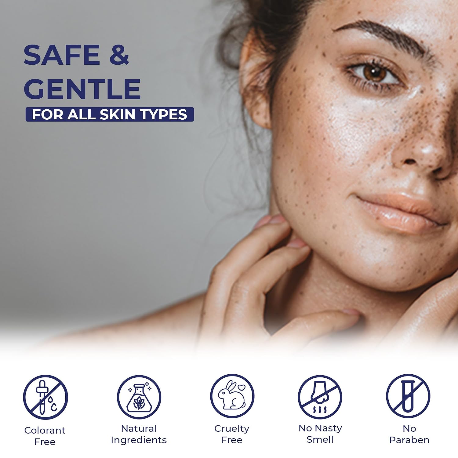 Treatment for Face - Melasma Cream & Age Spot Remover for Skin Discoloration. Post-Blemish Marks. Scars & Spots | Dark Spot Remover for Face & Body : Beauty & Personal Care