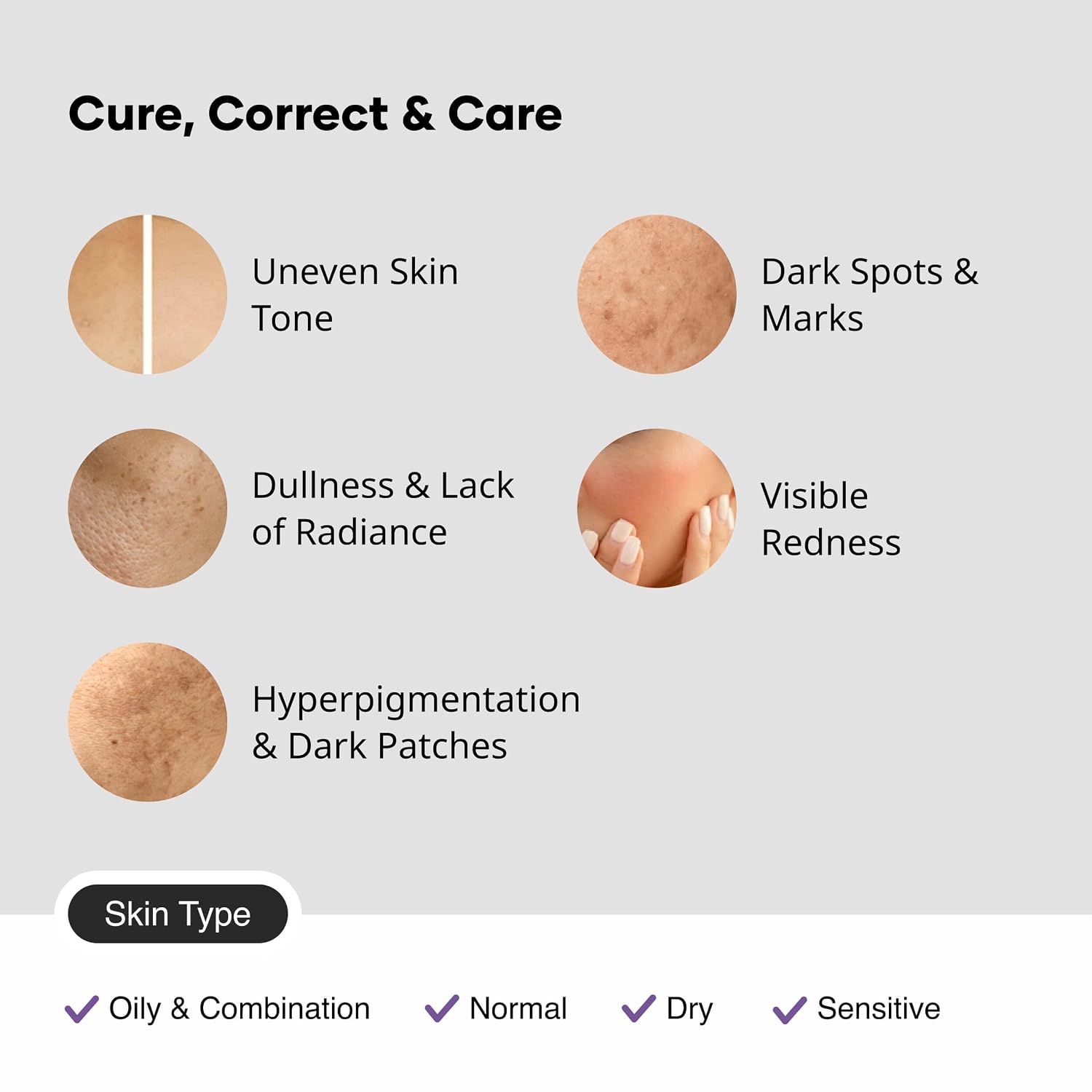 Cureskin Tranexamic Acid 10% Cream | 20.000 PPM Kojic Acid Dipalmitate. 15.000 PPM Alpha Arbutin. 100.000 PPM Tranexamic Acid | Dark spots. Freckle. Blemishes. Pigmentation (15g/0.5 Oz) : Beauty & Personal Care