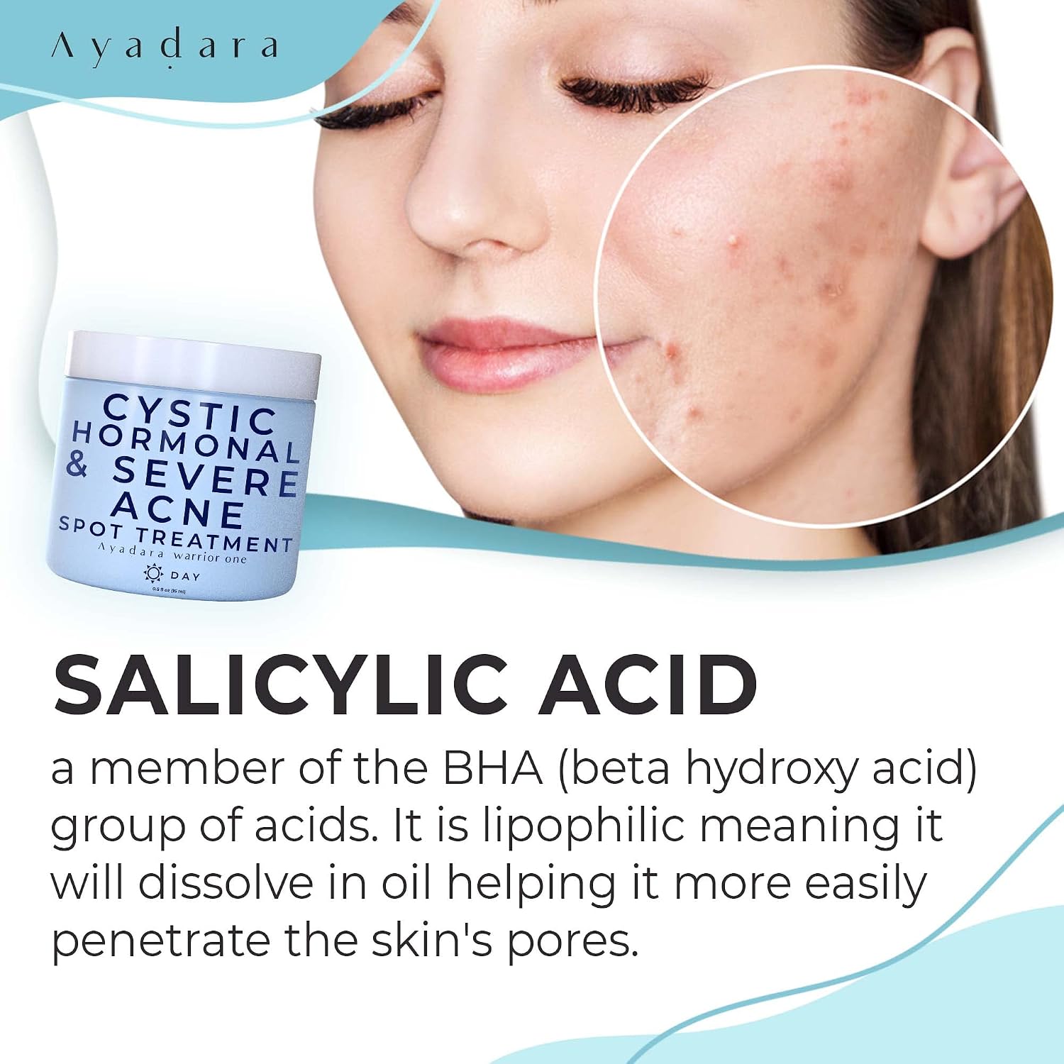 Ayadara Warrior One (0.5oz) Acne Spot Cream with 2% Salicylic Acid. Cystic and Hormonal Acne Cream. Acido Salicilico Acne Spot Care for Face. acne Cream for Adults and Teens. 150+ Uses