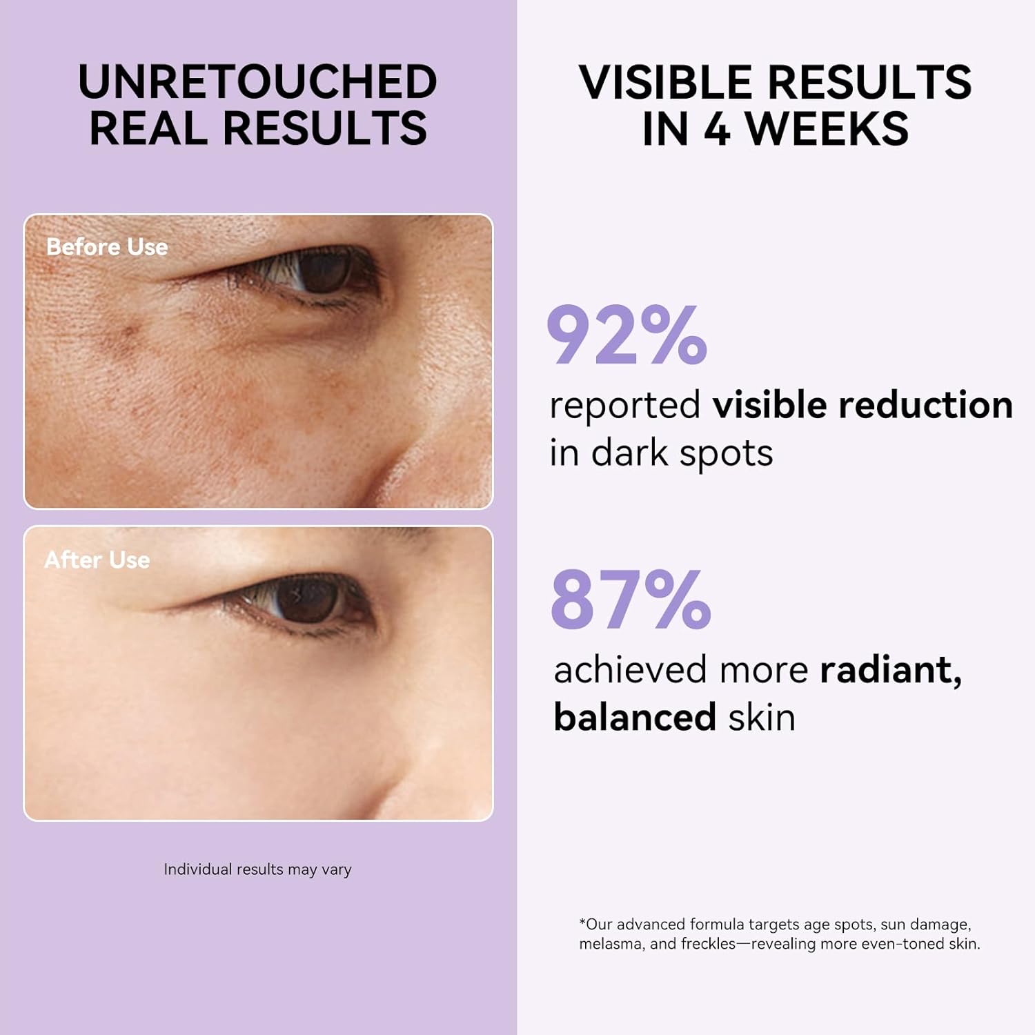 Dark Spot Remover for Face and Body - Dark Spot Corrector Serum for Sun Spots. Age Spots. Brown Spot. Freckles & Melasma - Skin Care Repair Evens Skin Tone for All Skin Type 1.69 Fl Oz : Beauty & Personal Care