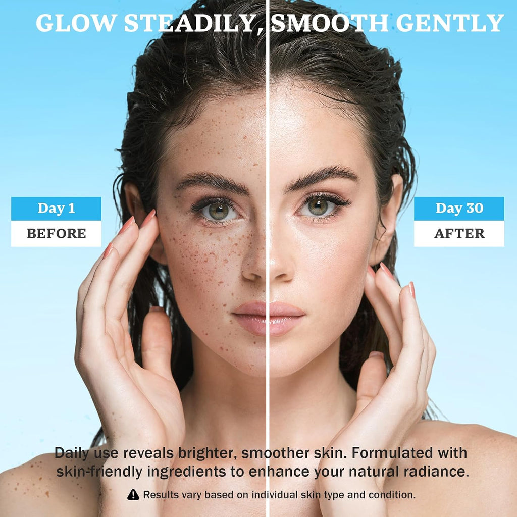 Dark Spot Remover for Face and Body: Dark Spot Corrector Cream. Melasma. Freckle. Sun Spot. Age Spot Remover with Niacinamide and Vitamin C - 1.7 Fl Oz : Beauty & Personal Care