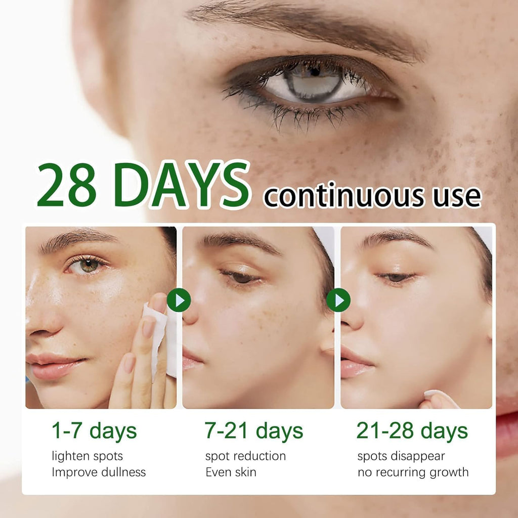 Crema para Manchas Oscuras en La Cara. Cremas para Quitar Manchas de La Cara. Crema Blanqueadora para Pecas. Elimina el Melasma Manchas Oscuras Aclara La Piel. 20g/0.71oz