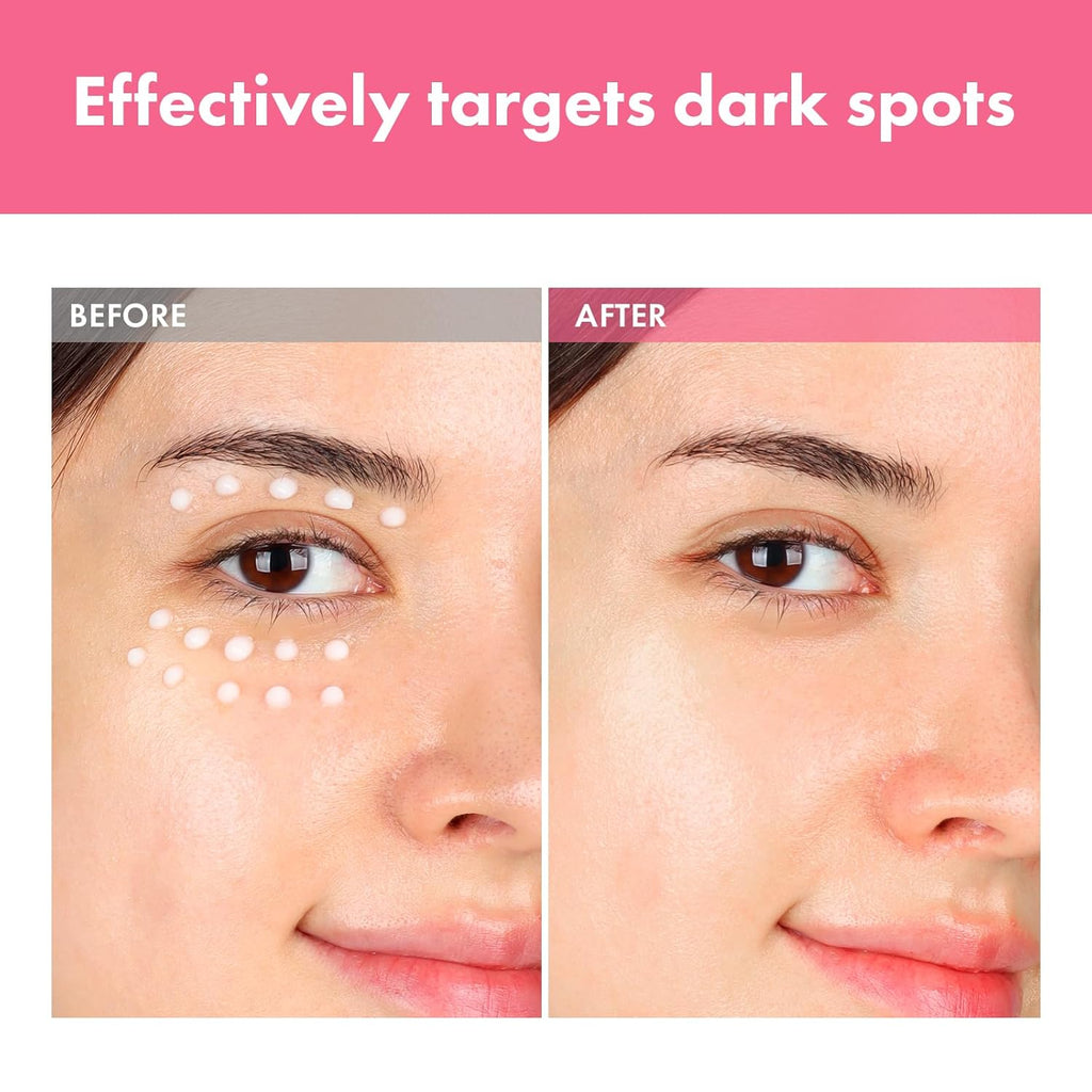Arbutin 7% Intensive Spot Cream with 70.000ppm Arbutin. 3% Tranexamic Acid. 1% Niacinamide. Glutathione. Dark Spots. freckle. Blemishes. Anti-pigmentation. Korean Skin Care. 20ml. 0.67 fl.oz : Beauty & Personal Care