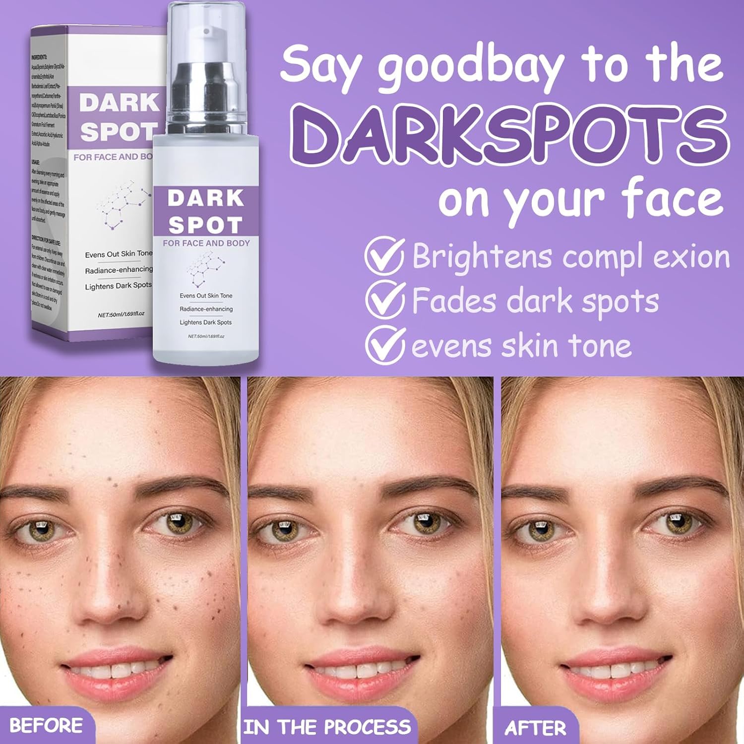 Dark Spot Remover for Face and Body: Dark Spot Corrector - Age Spot Sun Spot Freckles Dark Spot Remover. Melasma Treatment for Women and Men (1.7 FL OZ) : Beauty & Personal Care