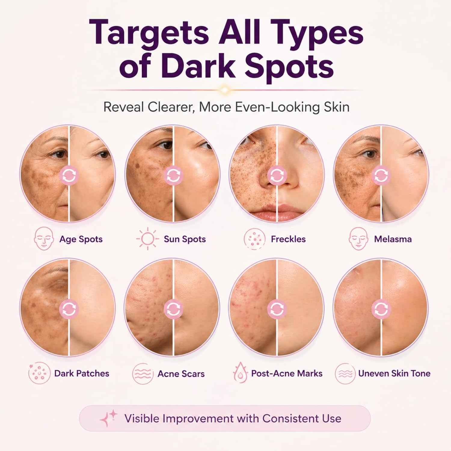 Dark Spot Remover for Face & Body. 35.6% Dark Spot Correcting Complex. Brightening Serum for Hyperpigmentation. Melasma. Age Spots. Acne Marks. Freckles & Uneven Tone. Made in USA. 1 fl. oz : Beauty & Personal Care