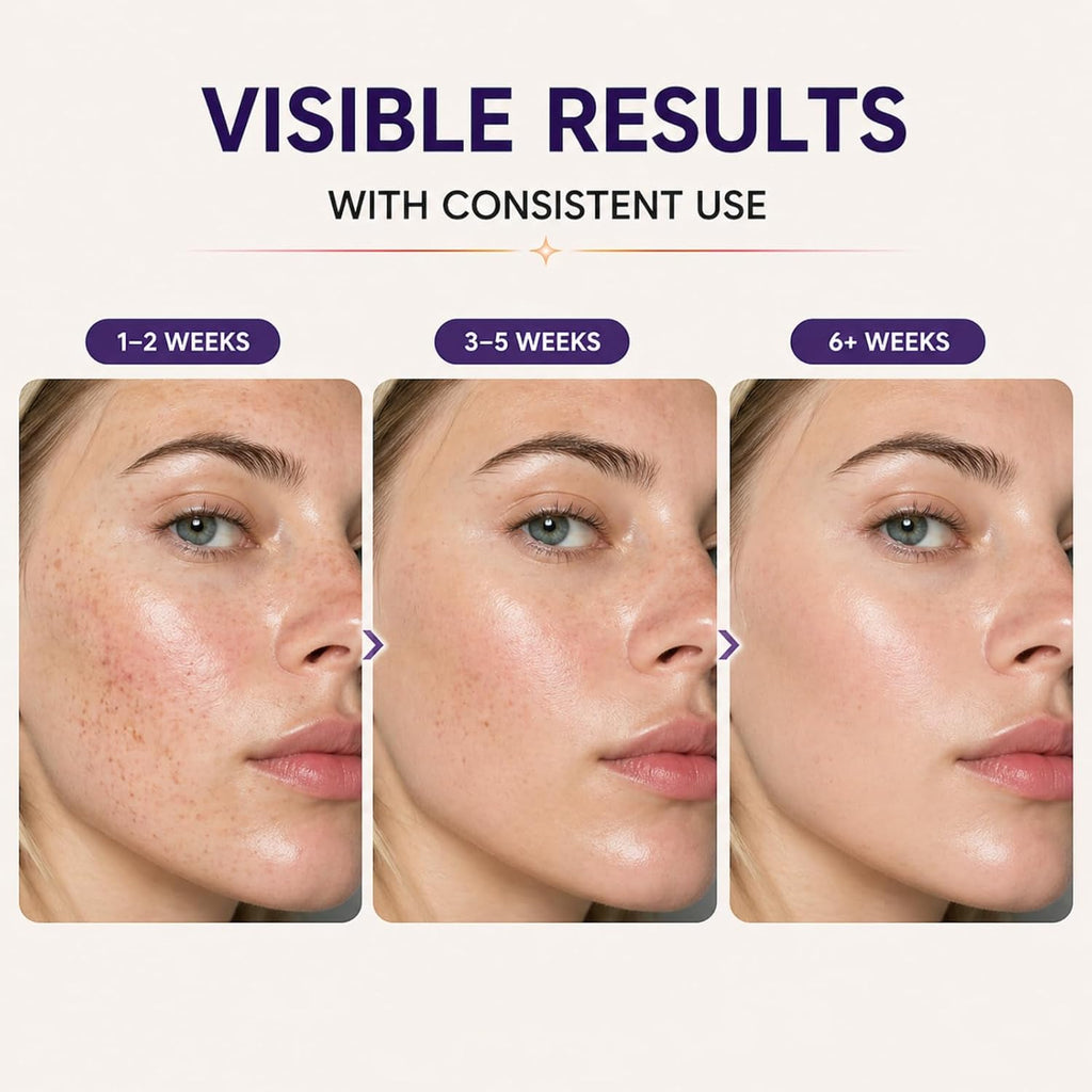 Dark Spot Remover for Face & Body. 35.6% Dark Spot Correcting Complex. Brightening Serum for Hyperpigmentation. Melasma. Age Spots. Acne Marks. Freckles & Uneven Tone. Made in USA. 1 fl. oz : Beauty & Personal Care