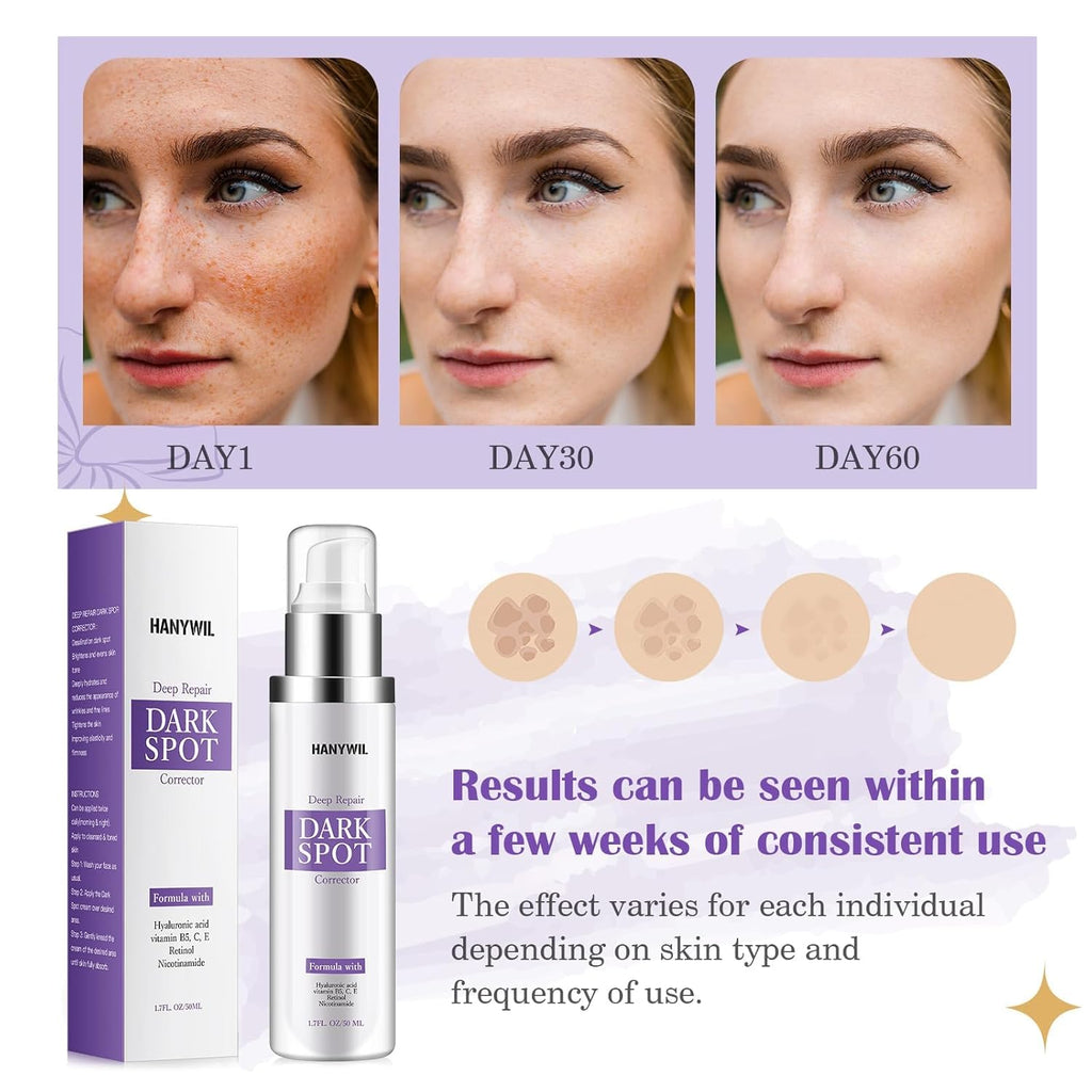 HANYWIL Dark Spot Remover for Face & Body Serum - 2% Retinol + 5% Niacinamide + Vitamin C for Face & Body. Melasma & Hyperpigmentation Treatment.Dermatologist Tested