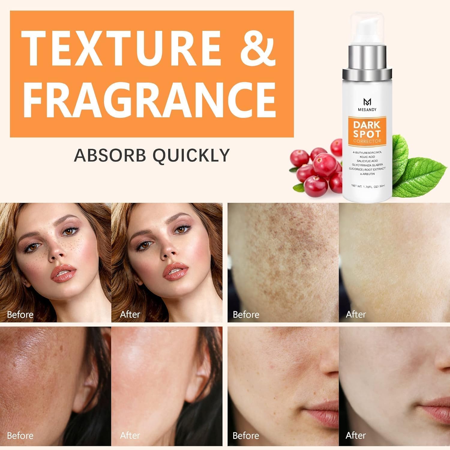 Dark Spot Remover For Face Body with 5% Niacinamide: Dark Spot Corrector for Sun Spots Freckles and Brown Spots Hyaluronic Acid & Peptides Anti-Aging Fade Cream Moisturizer for All Skin Types : Beauty & Personal Care