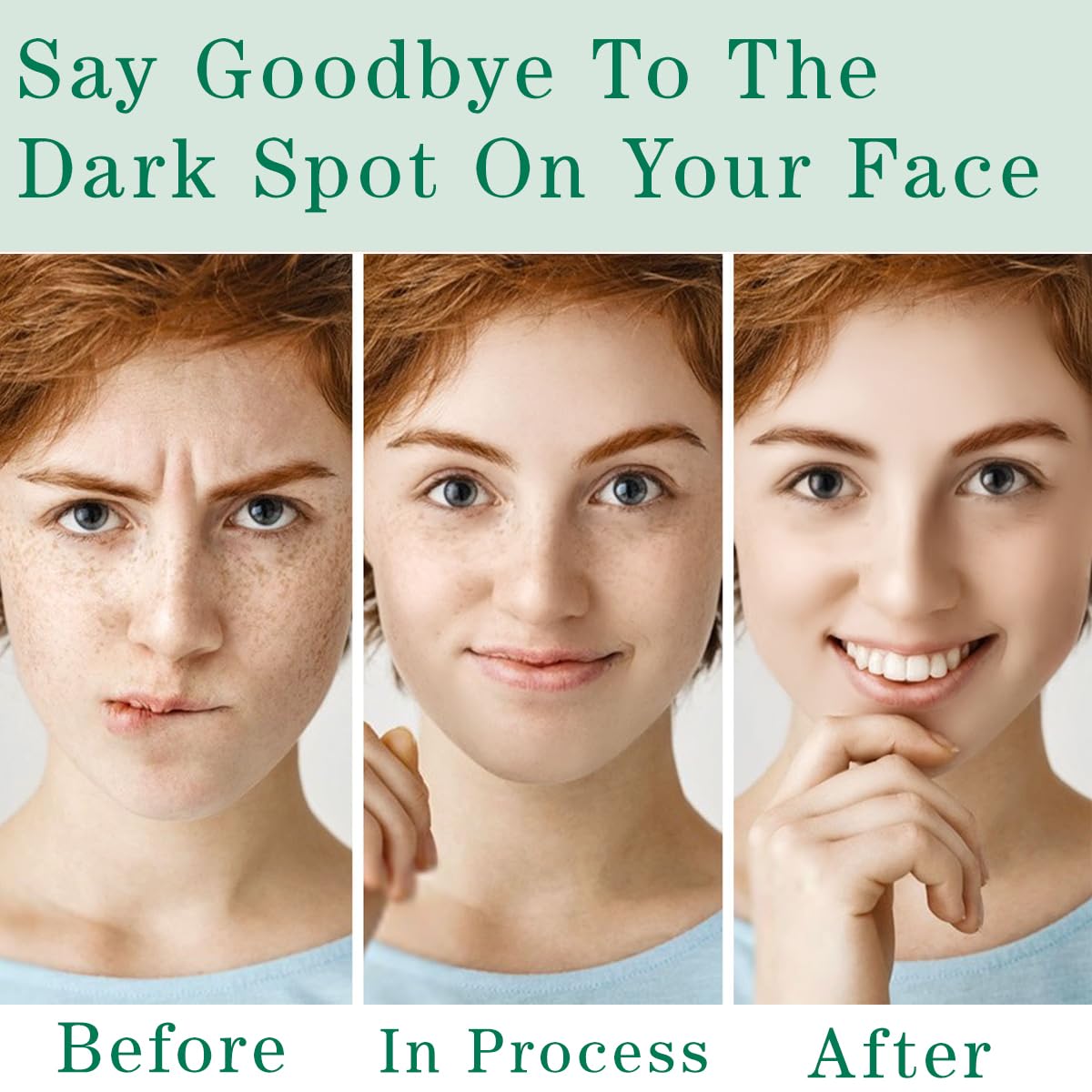 Dark Spot Remover for Face and Body.Dark Spot Corrector with Vitamin C.Nicotinamide.Sun Spot Remover Cream for All Skin Types.Fade Age Spots.Melasma. Freckle. Blemish Reducer.1.7 Oz : Beauty & Personal Care
