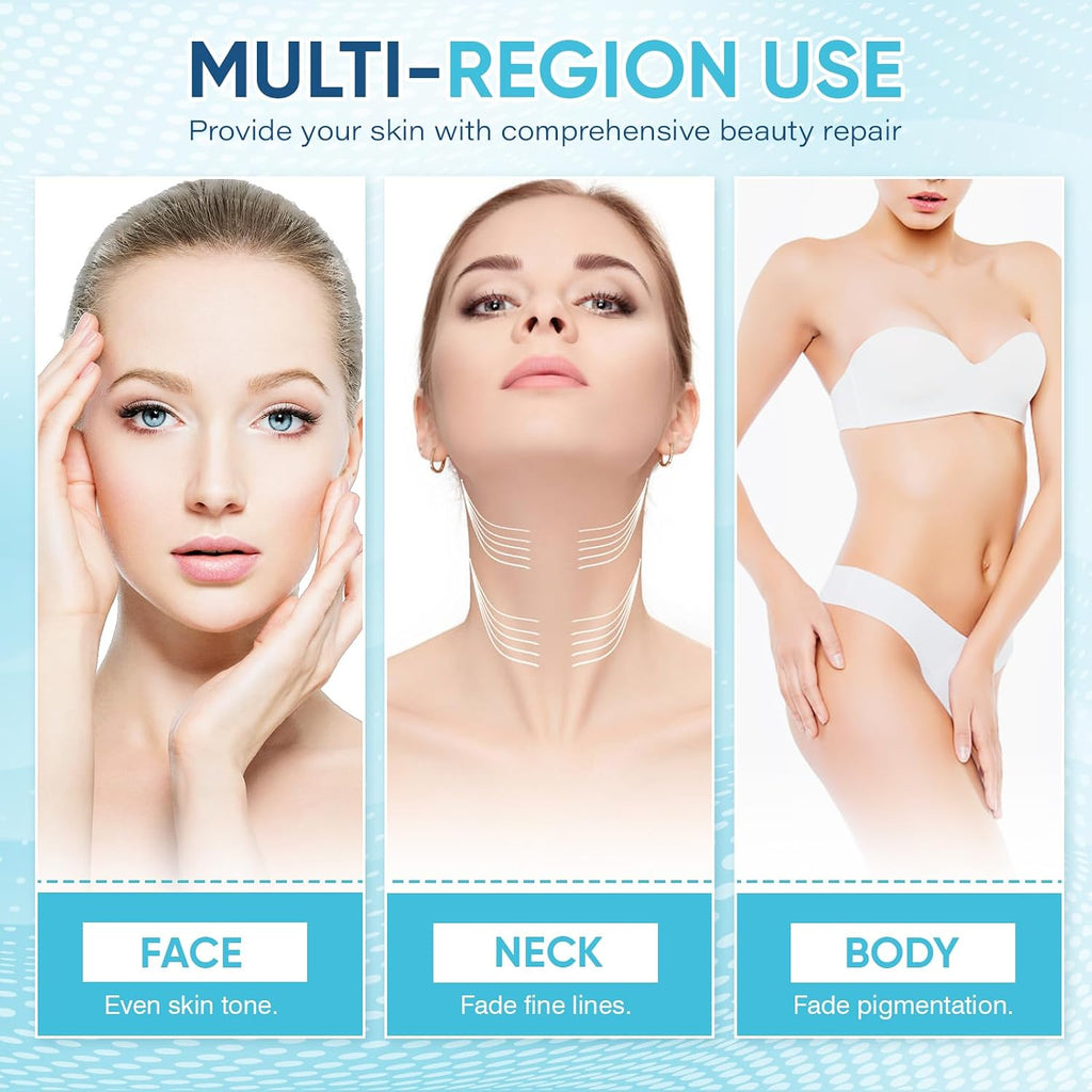 Hyperpigmentation Treatment Skin Brown Spot Age Spot Remover : Beauty & Personal Care