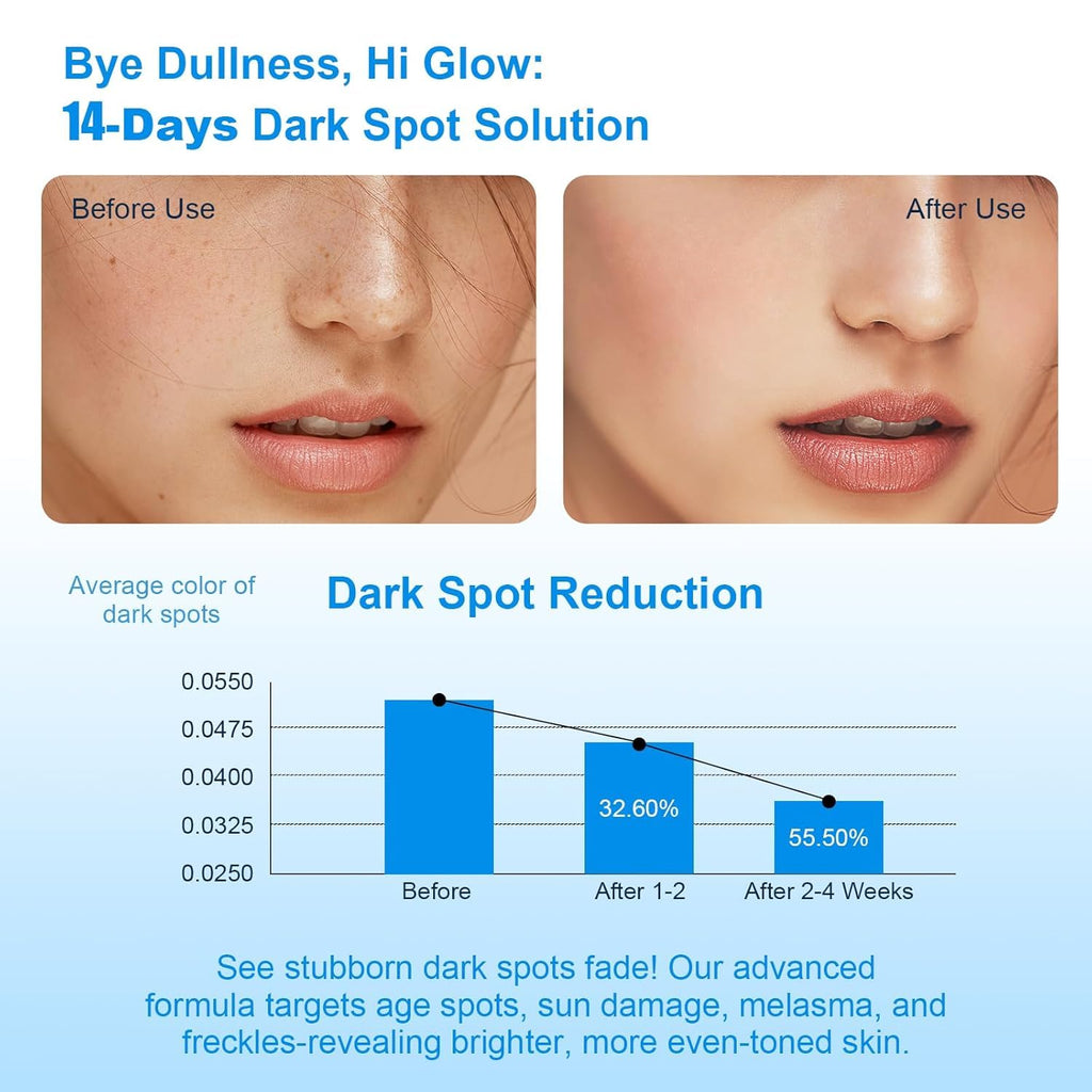 Dark Spot Remover for Face. Dark Spot Corrector. Dark Spot Serum for Sun Spots. Age Spots. Brown Spots.Acne Scars.Melasma Brown Spot -Advanced Formula with Niacinamide Vitamin C (1 Fl Oz (Pack of 1) : Everything Else