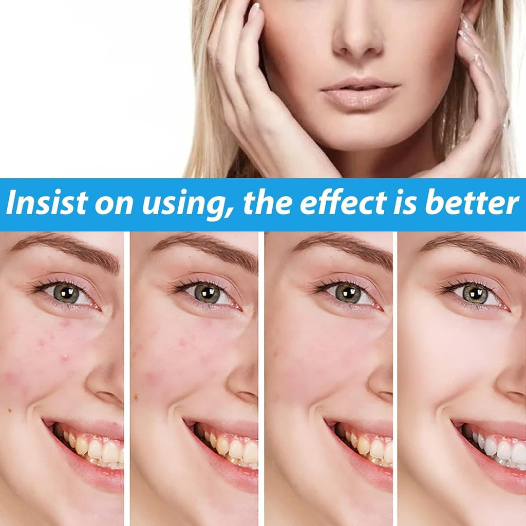 VoaiBekt Crema para Manchas Oscuras en La Cara. Cremas para Quitar Manchas de La Cara
