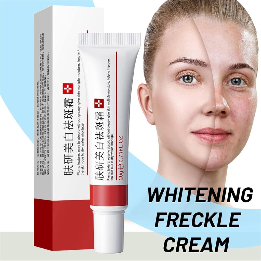 2 Pcs Whitening Freckle Cream. Acne Scar Removal Treatment Cream. Pigmentation Removal Cream for Face. Moisturizing Removes Facial Melasma Dark Spots Wrinkles Blemishes (whitening freckle cream) : Beauty & Personal Care