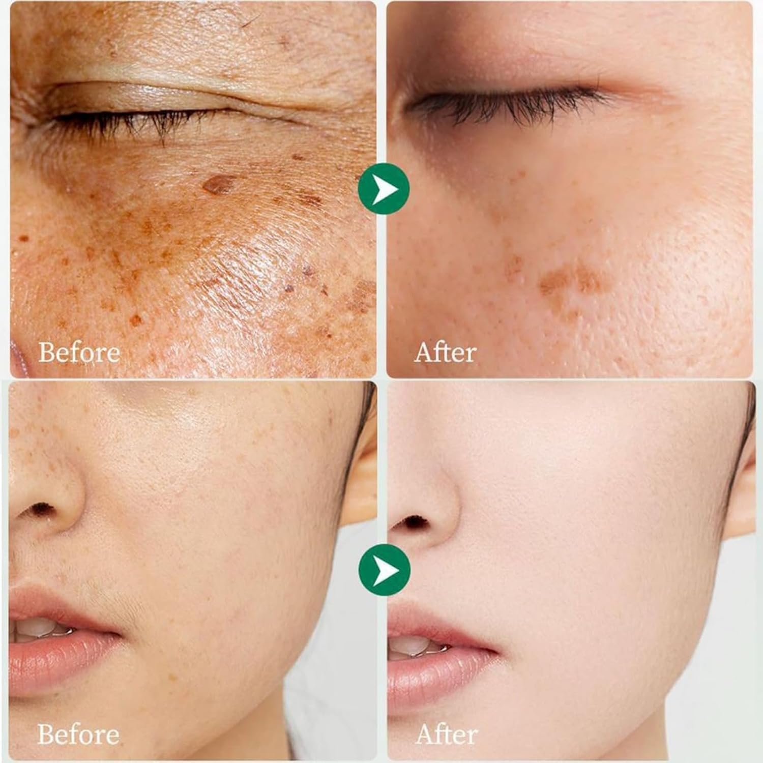 Crema para Manchas Oscuras en La Cara. Cremas para Quitar Manchas de La Cara. Crema para Las Manchas de La Cara. 50 ML / 1.7 FLOZ : Beauty & Personal Care