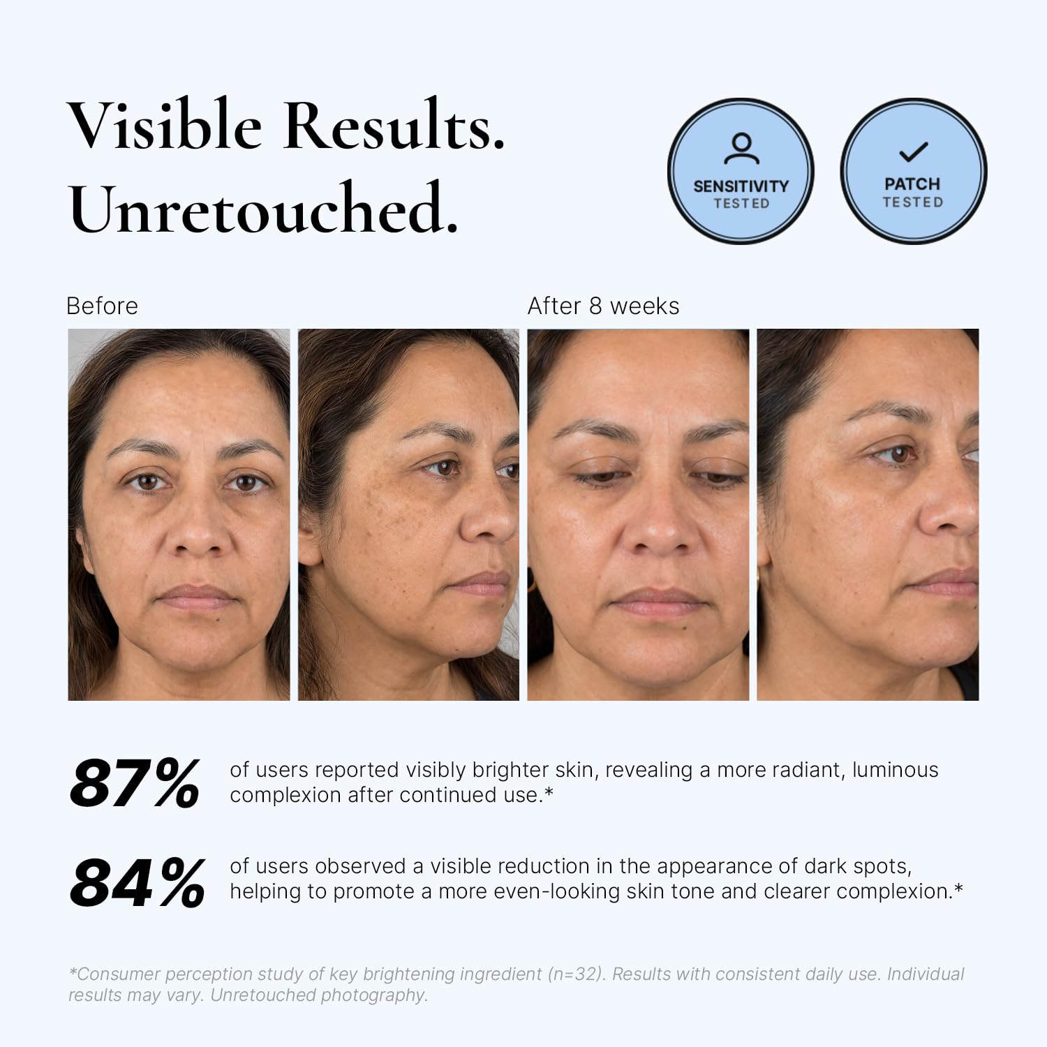 EnaSkin Dark Spot Corrector for Face & Body - 5% Tranexamic Acid. Niacinamide & Acid-Free Renewal Peptide - Hyperpigmentation. Melasma & Sun Spot Treatment. Gentle for Sensitive Skin. 1.01 fl oz : Beauty & Personal Care