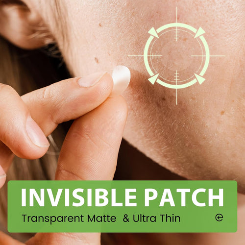 Amifiy Pimple Patches with Hydrocolloid & Tea Tree – Korean Skincare Invisible Acne Stickers for Face. Oil-Absorbing Zit Dots. Vegan & Cruelty-Free Blemish Treatment. 50 Count (10mm/12mm/14mm)