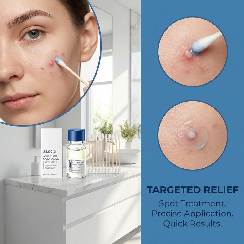 Acne Buster Salicylic Acid Drying Lotion. Pimple Spot Treatment for Acne and Blackheads. Fast Drying Facial Blemish Care with Cotton Swabs. Lightweight Oil Control Skin Care Solution 10ml (1pcs)