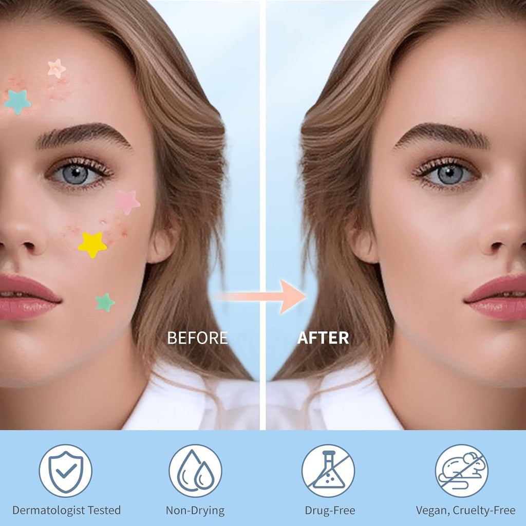 QUSTERE Pimple Patches for Face. Hydrocolloid Acne Patches. Cute Star Zit Covers. Colorful Spot Stickers with Tea Tree. Salicylic Acid & Cica Oil| 3 Sizes (10mm. 12mm & 14mm)