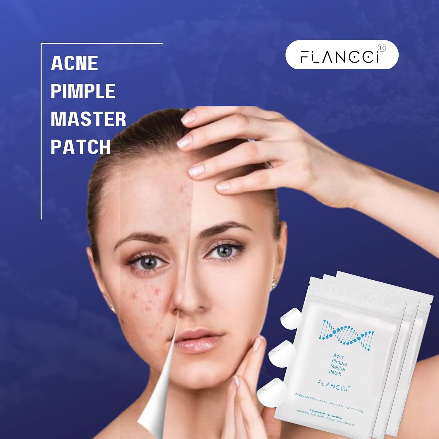 FLANCCI Pimple Patch Acne Patches Facial Skin Care Products. Blackhead Remover. Pimple Patch for Face and Hydrocolloid Acne Treatment Patch Salicylic Acid. Acne Spot Treatment (120 Count (Pack of 5))