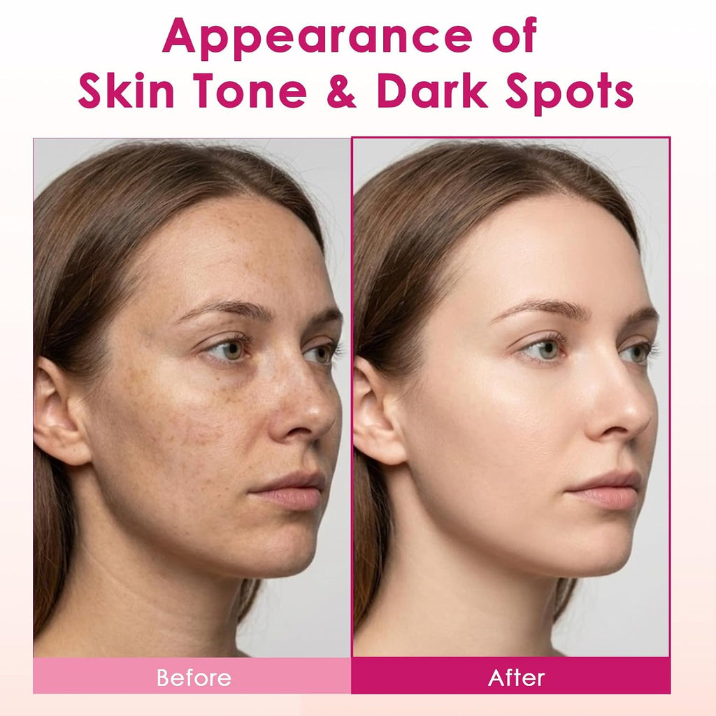 Arbutin 7% + Tranexamic Acid 4% Cream with Niacinamide 1% for Dark Spots & Pigmentation Concerns. Uneven Skin Tone – Moisturizing. Non-Irritating Skin Barrier Care for Sensitive Skin. 1.76 oz : Beauty & Personal Care