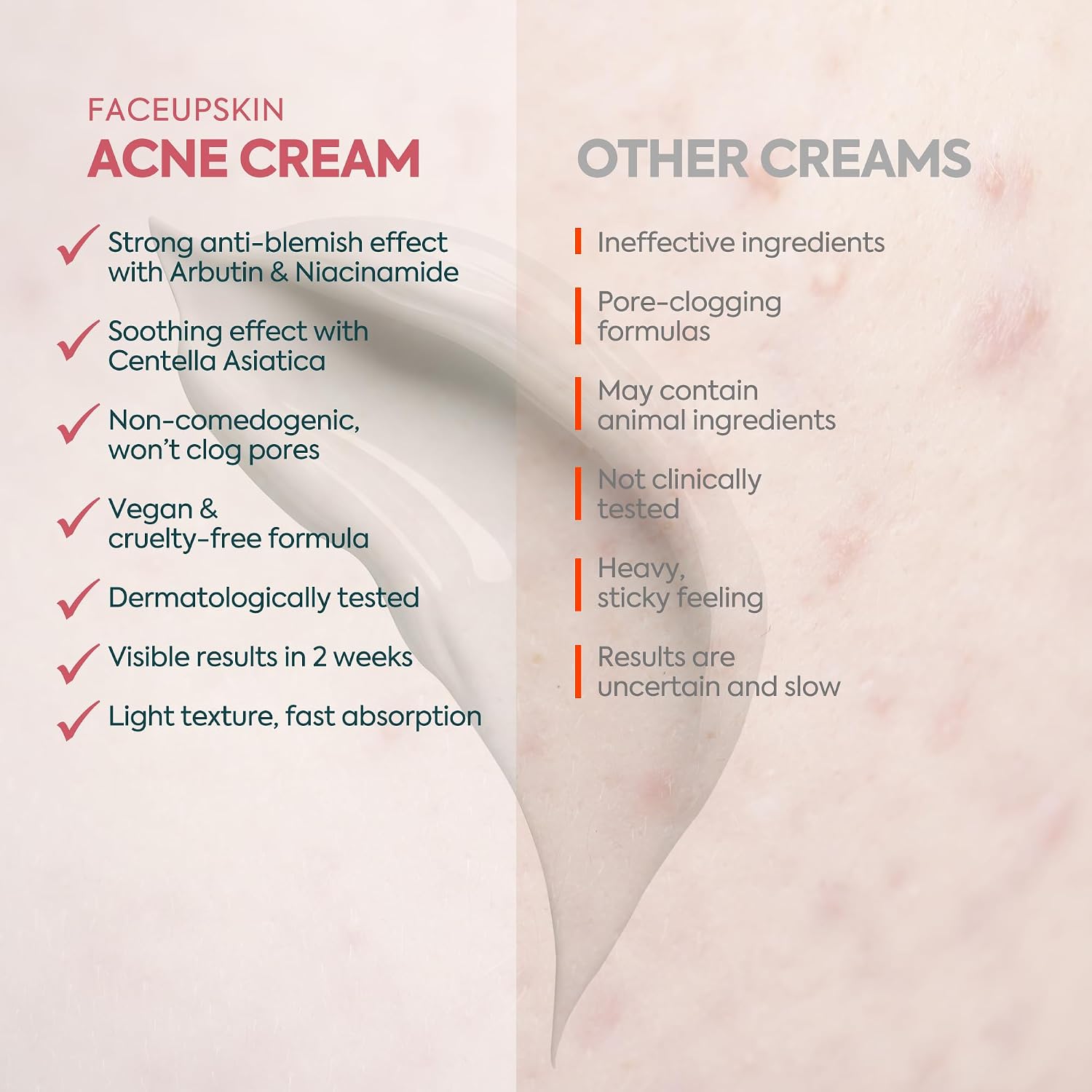 Clasy Care Acne Cream for Face – Spot Treatment for Pimples & Acne Scars – Salicylic Acid & Niacinamide for Scar Removal – Teen & Adult Skincare with Zinc PCA