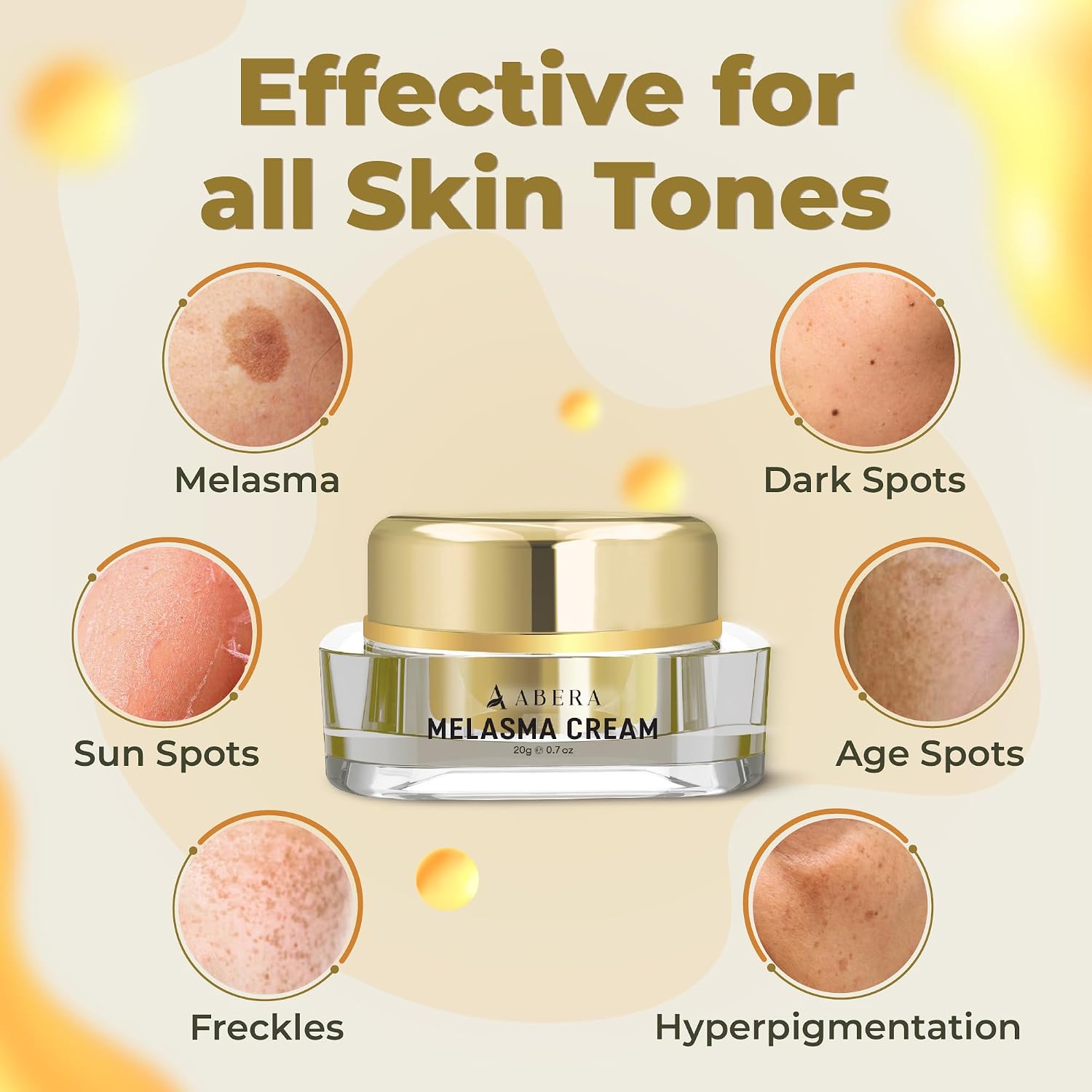 Melasma Cream. Dark Spot Corrector - Melasma. Freckle. Sun Spot. Age Spot Remover Advanced Formula for Women and Men (0.7 Oz Per Item) : Beauty & Personal Care