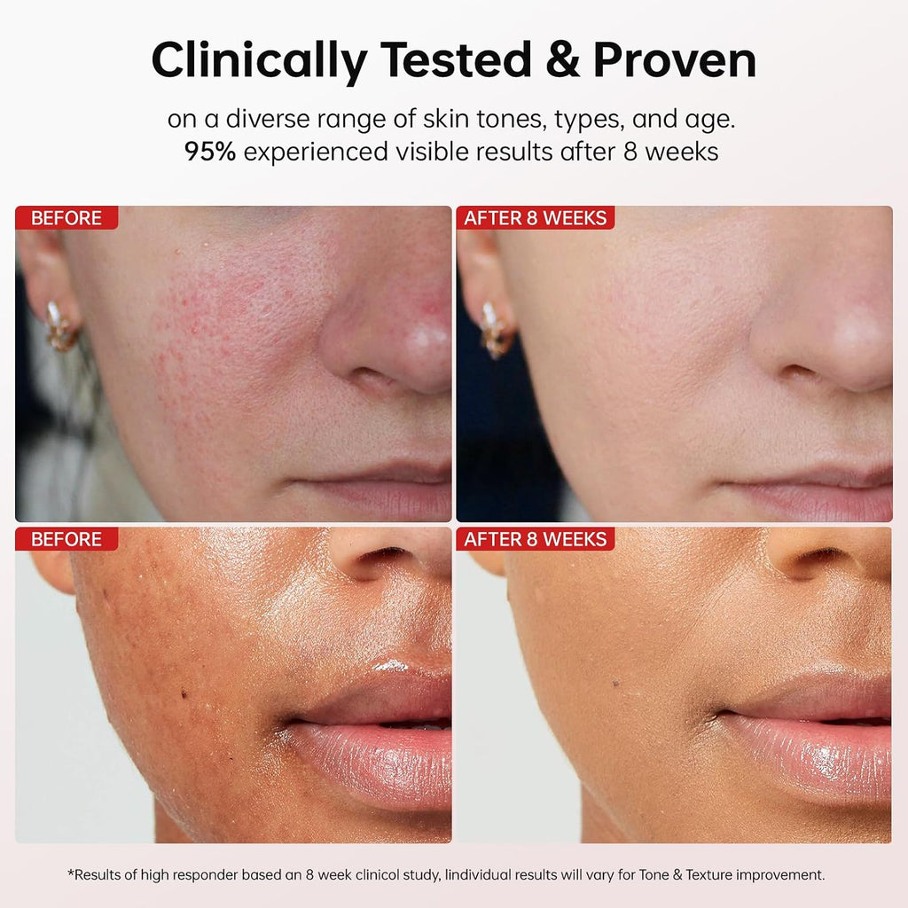 Dark Spot Remover for Face and Body: Corrector for Age Spots Sun Spots Freckles Melasma Brown Spots