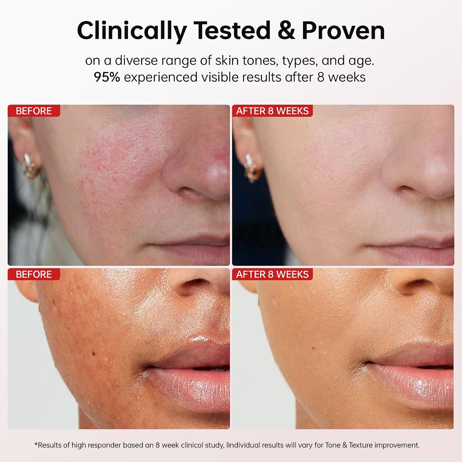 Dark Spot Remover for Face and Body: Corrector for Age Spots Sun Spots Freckles Melasma Brown Spots