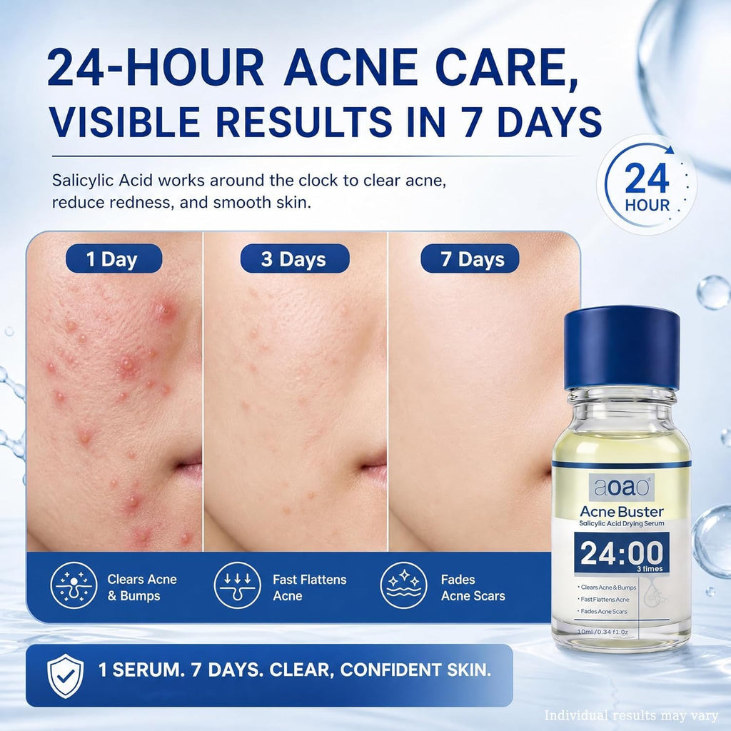 Salicylic Acid Acne Serum. Acne Drying Lotion for Acne-Prone Sensitive Skin. Shrinks Pimples Overnight. Fade Acne Marks. 20% Zinc Oxide Medicated Spot Treatment for Pimples and Blemishes. 0.34 fl oz : Beauty & Personal Care