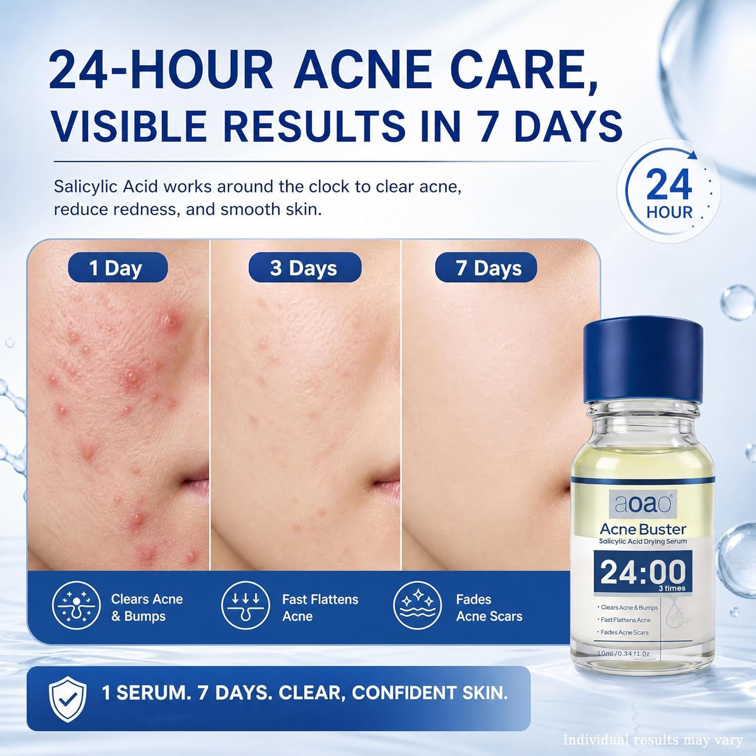 Salicylic Acid Acne Serum. Acne Drying Lotion for Acne-Prone Sensitive Skin. Shrinks Pimples Overnight. Fade Acne Marks. 20% Zinc Oxide Medicated Spot Treatment for Pimples and Blemishes. 0.34 fl oz : Beauty & Personal Care