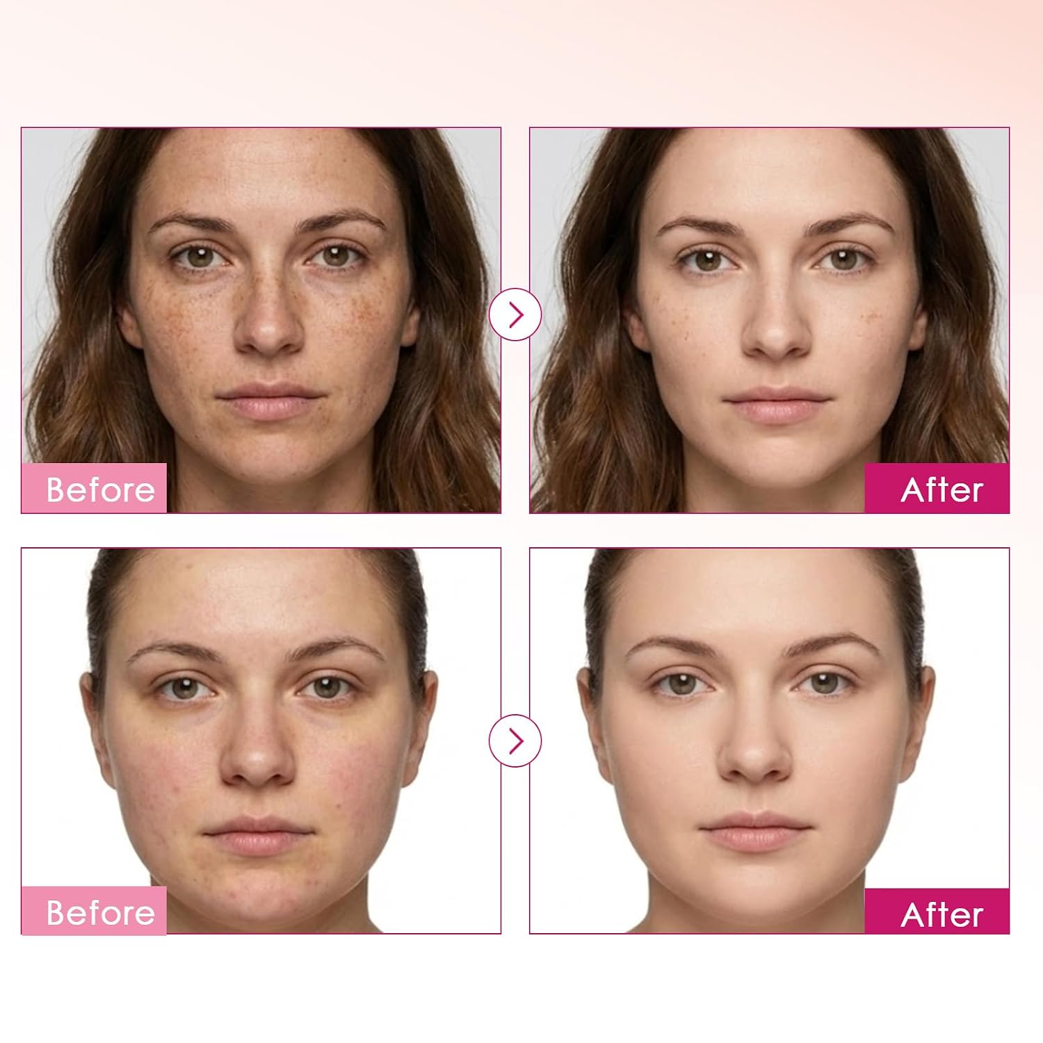 Arbutin 7% + Tranexamic Acid 4% Cream with Niacinamide 1% for Dark Spots & Pigmentation Concerns. Uneven Skin Tone – Moisturizing. Non-Irritating Skin Barrier Care for Sensitive Skin. 1.76 oz : Beauty & Personal Care