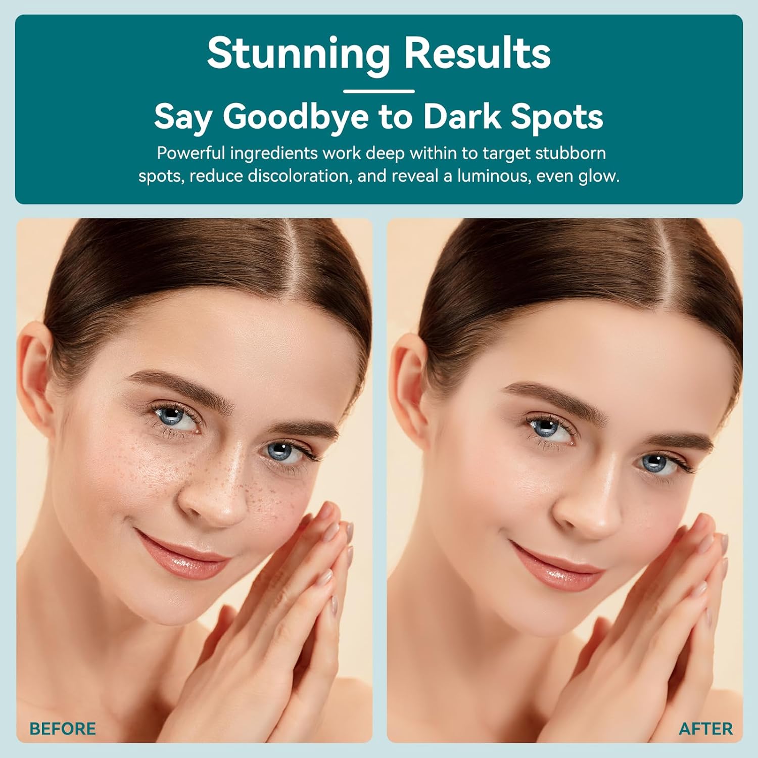 Dark Spot Remover for Face with 360° Roller Massage Ball. Dark Spot Corrector Serum for face. Fade Sun Spot Age Spot Brown Spot for All Skin Types. 0.67 FL OZ