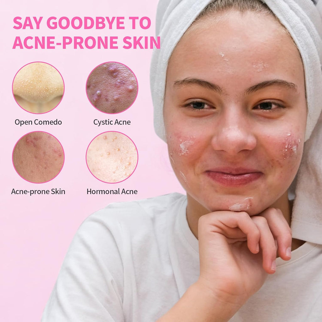 Acne Serum for Face. Back and Body. Gentle Skin Care for Acne Prone Sensitive Skin | For Women & Men : Beauty & Personal Care