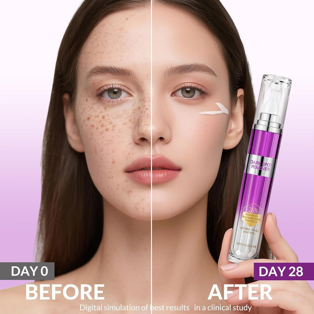 Dark Spot Remover for Face and Body. Age Spot Sun Spot Freckles Remedy Corrector Serum.Melasma Treatment for Face. Advanced Fade Cream for Uneven Skin Tone with 360° Roller Massage Ball. 0.5 FL oz : Beauty & Personal Care