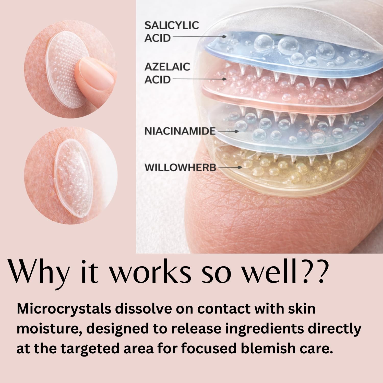ivoryloom Microdart Spot Patch | Targeted Blemish Care with Salicylic Acid. Azelaic Acid. Niacinamide and Willowherb | For Early-Stage Blemishes | 8 Patches