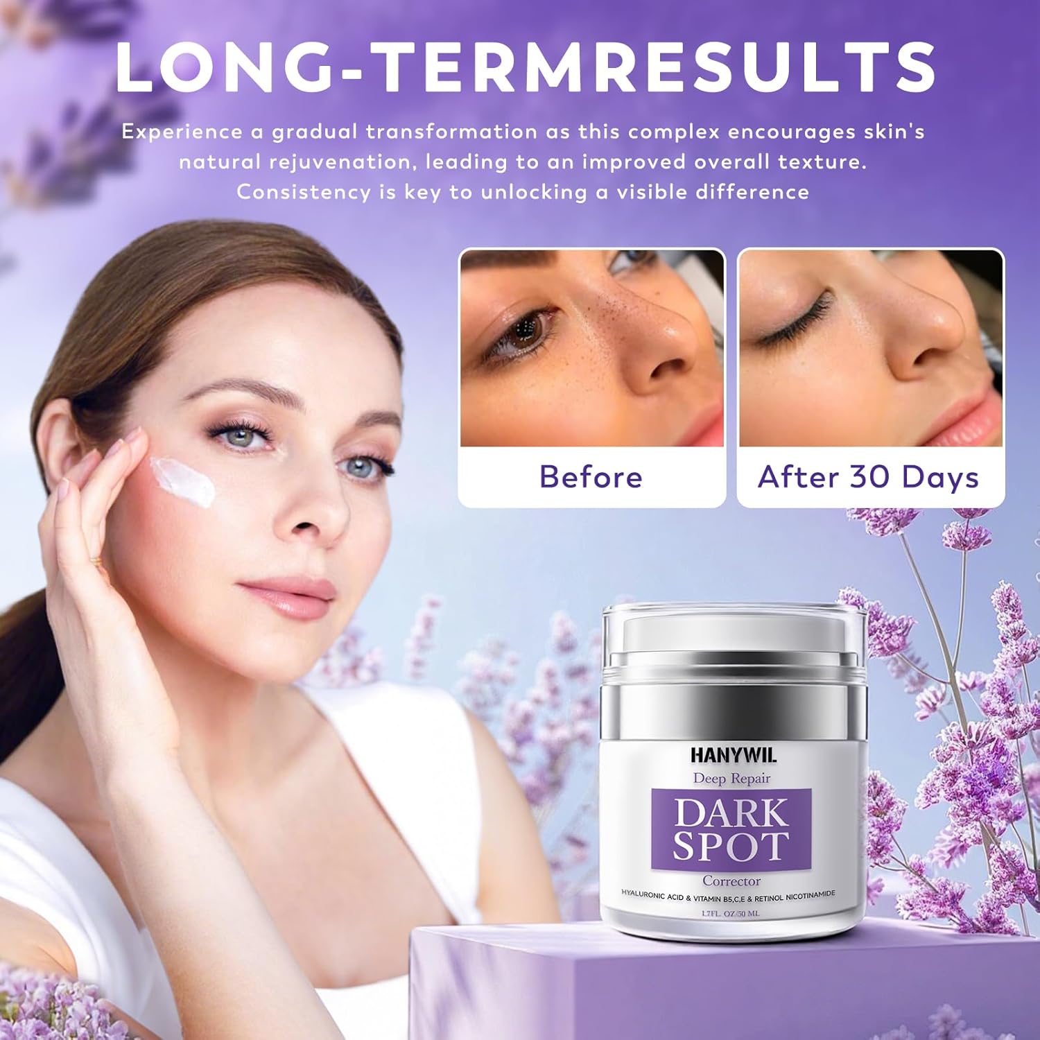HANYWIL Dark Spot Remover for Face & Body. Remedy for Dark Spots with Natural Ingredients. Dark Spot Corrector Cream and Serum for Skin Care. Treats Freckles. Melasma. Sun Spots. Women & Men.1.7 Fl Oz : Beauty & Personal Care